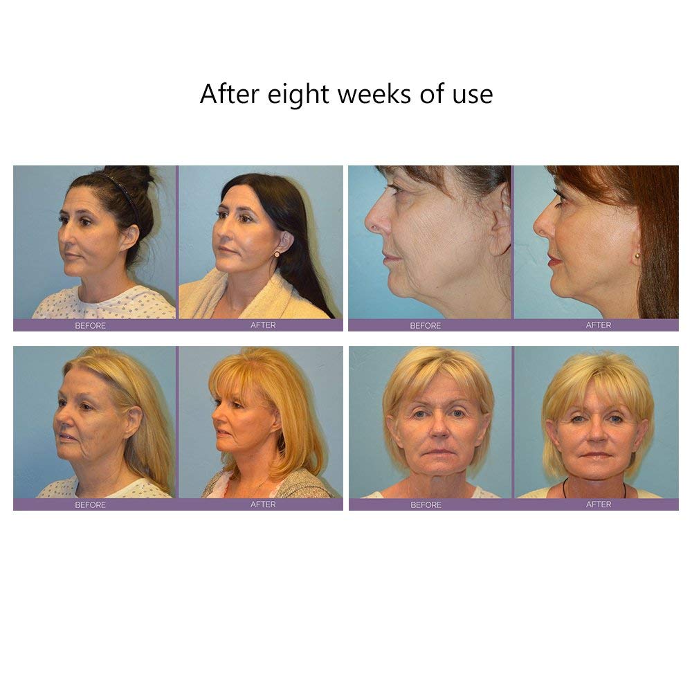 ZenFacial - Premium Microcurrent Face Massager